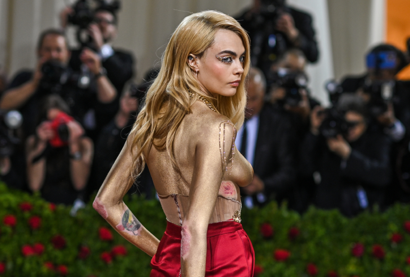 Не комплексовать, а подчеркивать: Кара Делевинь на Met Gala сделала псориаз частью образа — и вот, как это выглядит .